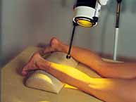 Anwendungsbeispiel Spectrochromtherapie Beine